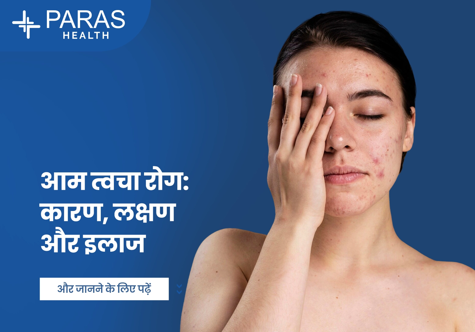 त्वचा रोग कब खतरनाक होता है? लक्षण और घरेलू उपाय जानें - Twacha Rog